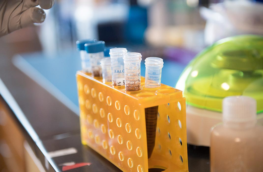 Lab samples