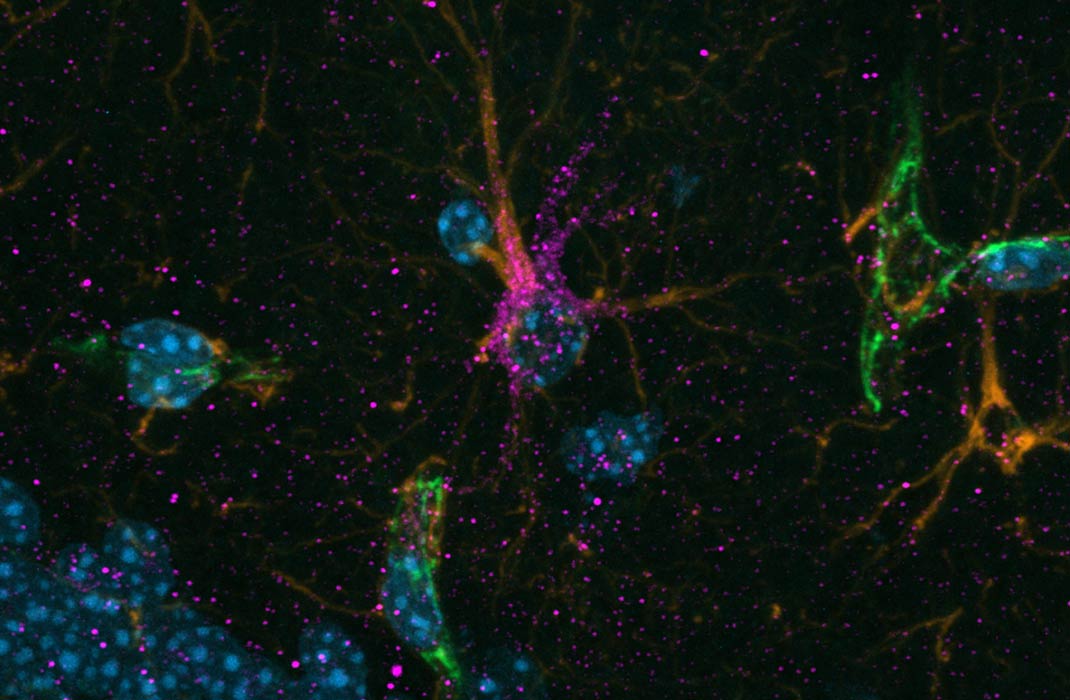Brain support cells—astrocytes enriched in the protein cadherin-4 (CDH4)