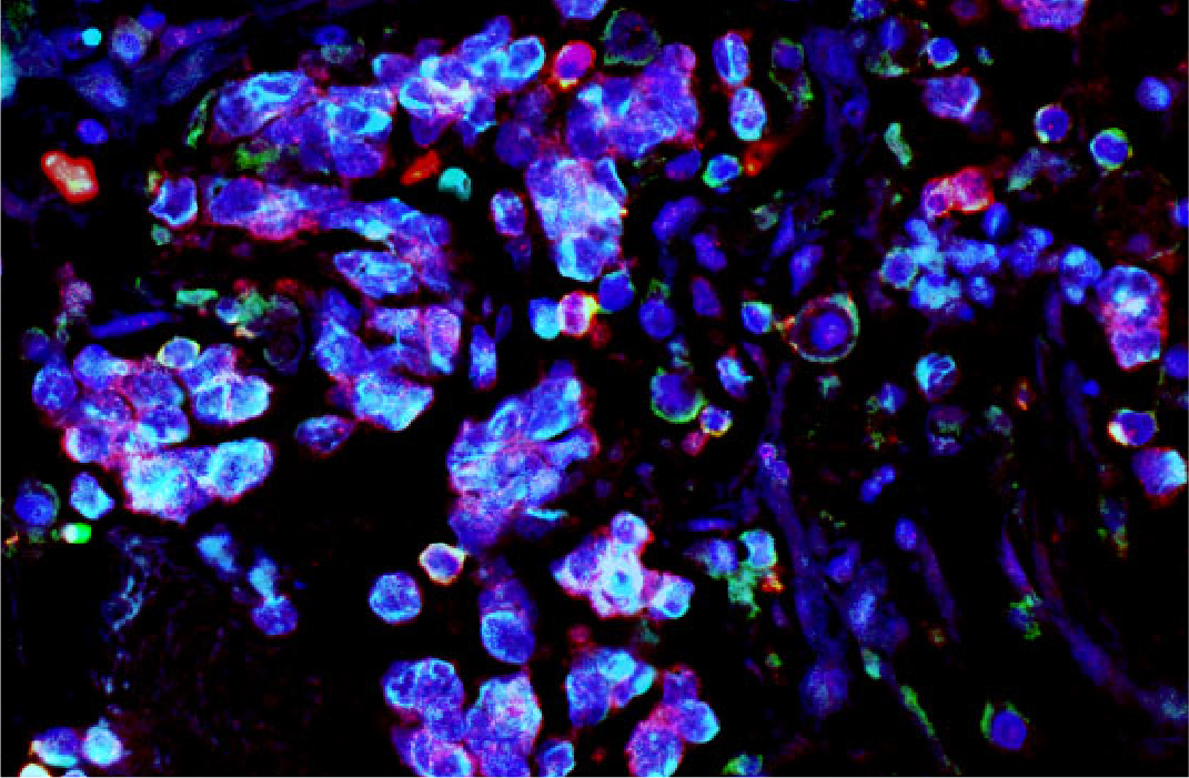 Merkel cell PD-1 expression